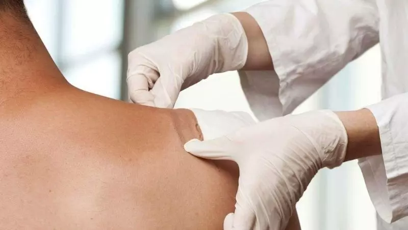 Imagem do curso: Noções Básicas de Cuidados Aplicados as Feridas